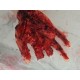 Blessure de la main par explosion