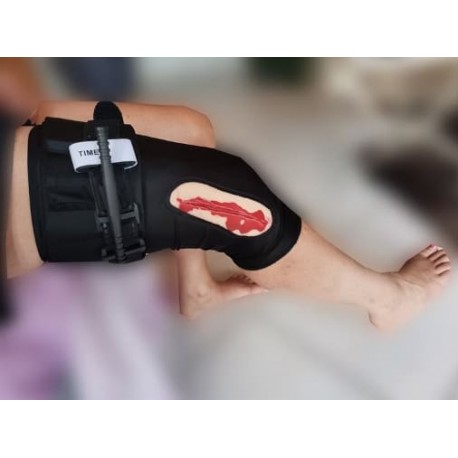Manchon tissu hémorragique de la jambe pose de garrot