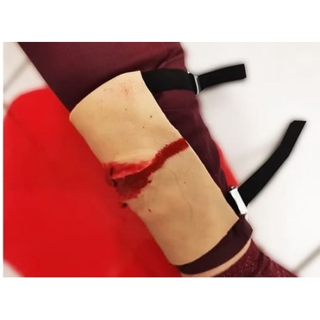 Support de plaie fixe petit modèle avec plaie
